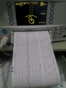 monitores y doloooor